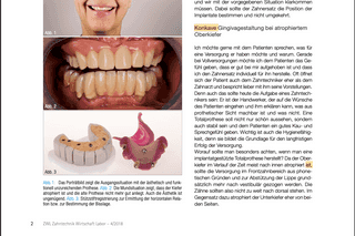 Prosthetic challenge: When the implant position determines the prosthesis